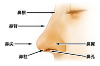 矫正驼峰鼻的方法有哪些