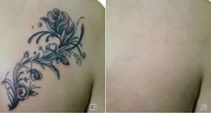 洗纹身怎么保养 a944ad65a23cafad25bd7412b42a6dd8.jpg