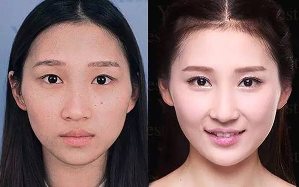 艺星美杜莎媚眼术案例图片
