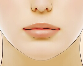 丰唇手术的适应症有哪些
