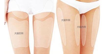 大腿吸脂时应该吸哪里