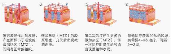 武汉激光美容吗