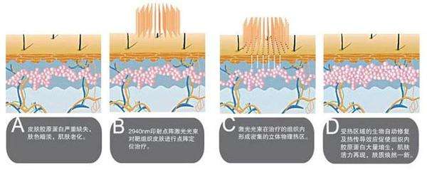 武汉影响祛痘价格的因素有哪些?颜值IN季