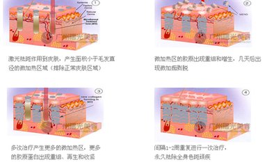 哪种方式去老年斑好?