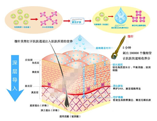 美塑去痘印有哪些优势?