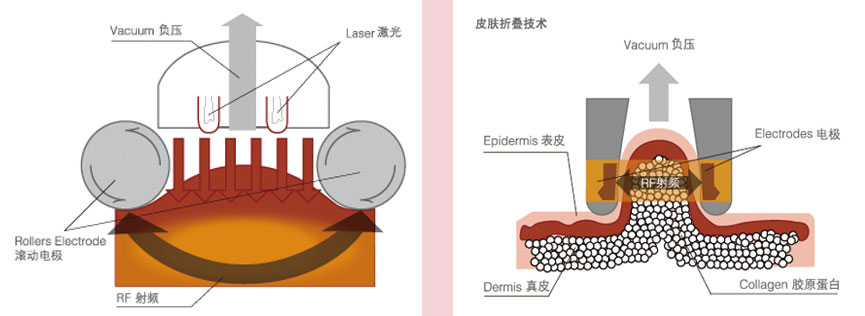 武汉激光去除黑眼圈大致需要多少钱?