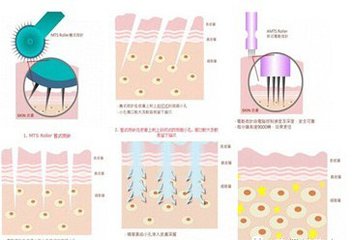 皮肤粗糙怎么办?美塑来拯救!