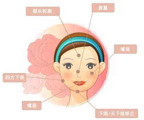 武汉注射瑞兰玻尿酸的价格高不高?