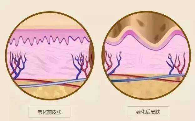 武汉激光除皱术的原理是怎样的