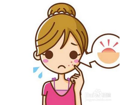 武汉激光祛痘后会反弹吗