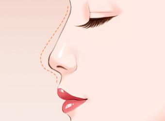 鼻子对于人的面部美观很重要，