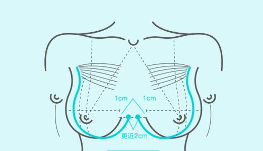 武汉乳头整形术后怎么护理