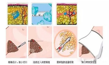 轻盈粉是什么原理减肥的_幸福是什么图片(2)
