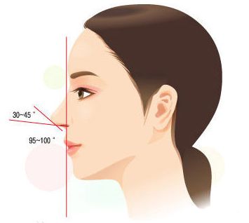 武汉韩式隆鼻价格多少钱