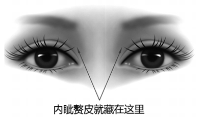 武汉开眼角效果好不好呢