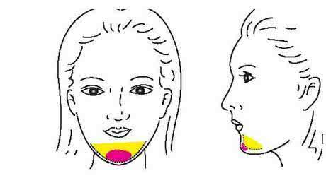 武汉丰下巴有什么方式