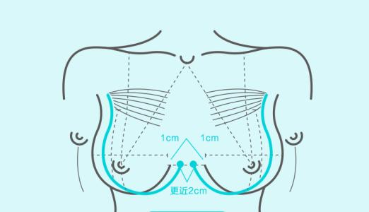 武汉胸部下垂对生育会有影响吗
